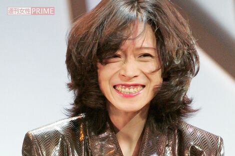 中森明菜、約8年ぶりディナーショーの“強気すぎる”価格設定が話題も「当然の値段」ファンが納得する“神内容”《2026年8月Choice》