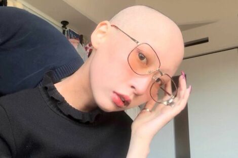 ステージ4のがんと闘う29歳のTiktoker・サイタマさん「思い切ってスキンヘッドに」明かしたイマを楽しむ“心の支え”