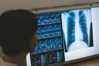 【知って楽しい雑学】「健診」と「検診」どう違うの?同じ“けんしん”でも全然違う!週女世代に受けてほし…